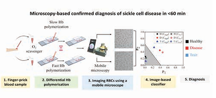 Point of Care Microscopy Test for Sickle Cell Anaemia