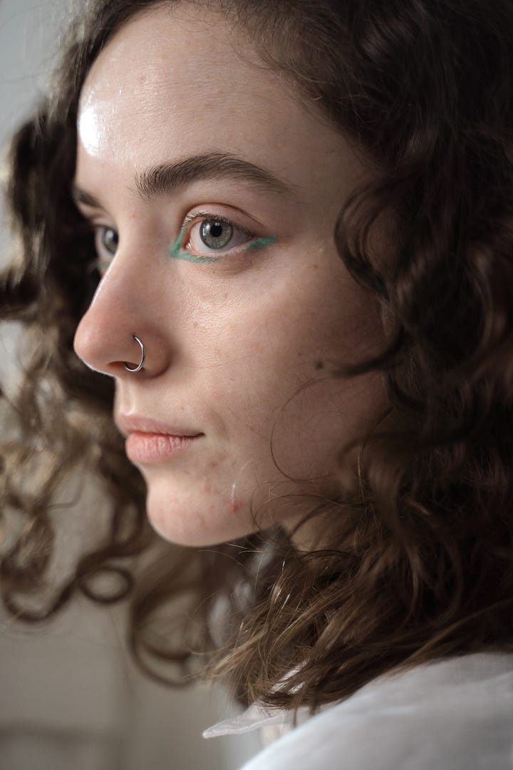 Fungal Acne vs Closed Comedones