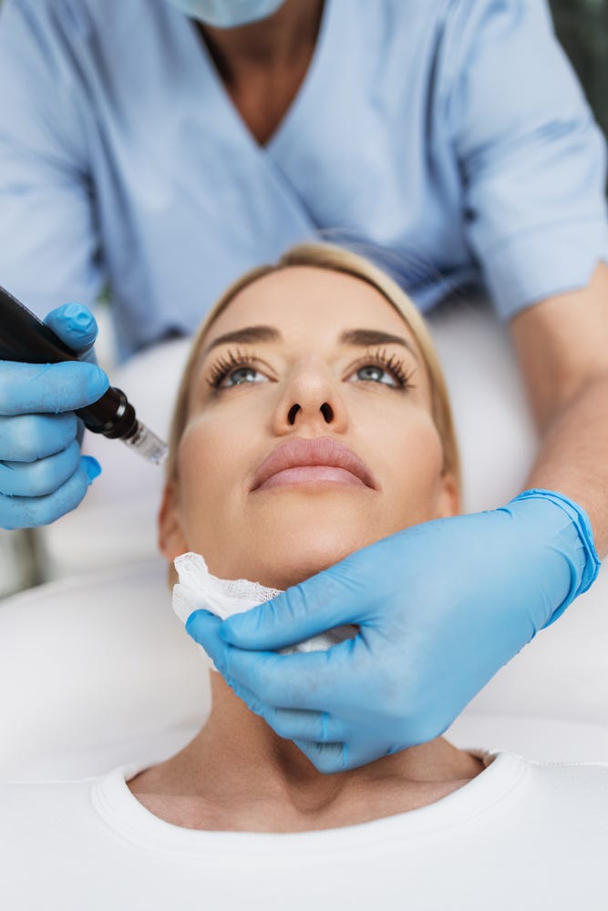 Microdermabrasion vs Microneedling