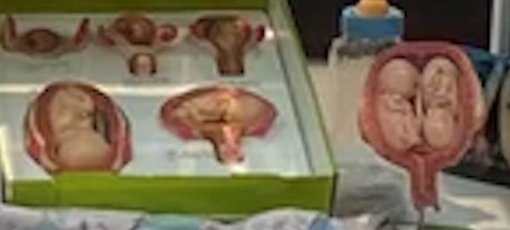 fetal model display