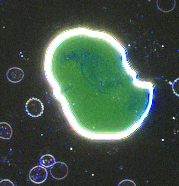 Varying complex chemistry observed in lamellar structures from blood. Karl Coronas