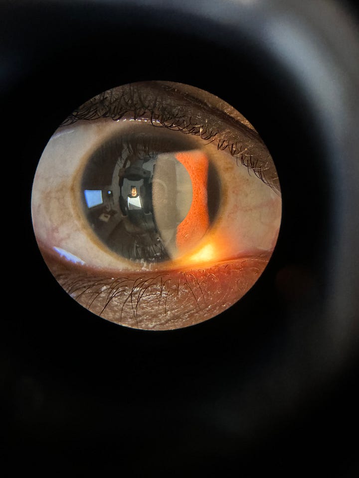 (Image 1) A photo of ArmaniXR's IRL avatar being examined with a slit lamp, which is a beige machine. ArmaniXR holds a circular green-tinted lens up to one eye. He is wearing a white KN95 mask. (Image 2) A close-up photo of ArmaniXR's eye. A reflection of the room can be seen in his iris and pupil. There is a glowing orange light reflected onto his eye.