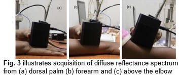 Transdermal Collagen and Hemoglobin Sensor