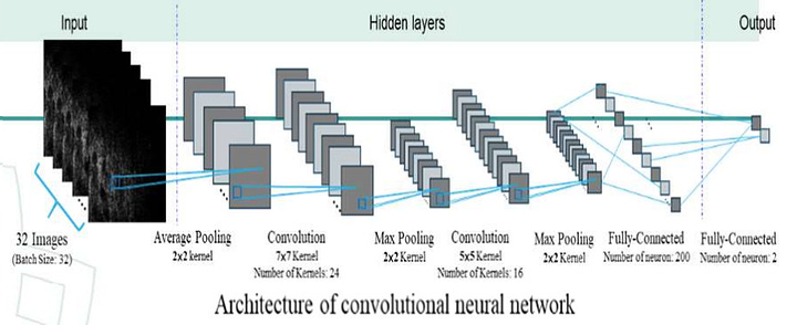 Convolutional Neural Network Classification of Basal Cell Carcinoma