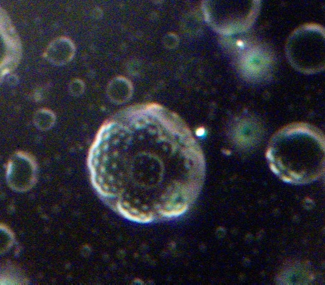 Complex cell structures with pitted surface, some with lipid structures inside.