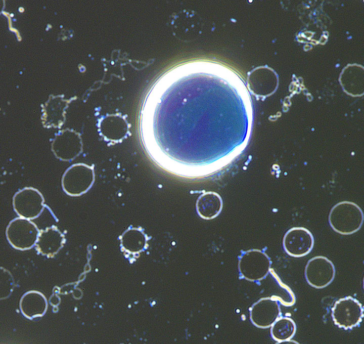 Varying complex chemistry observed in lamellar structures from blood. Karl Coronas