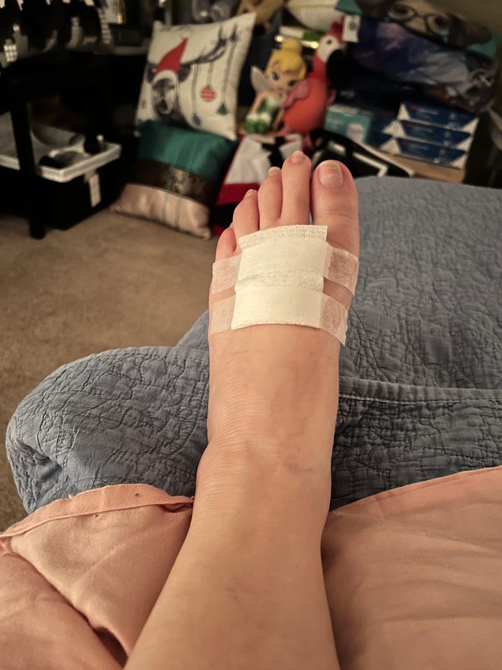 image of injured foot, unbandaged and bandaged