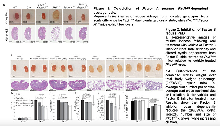 Novel Targets for Polycystic Kidney Disease