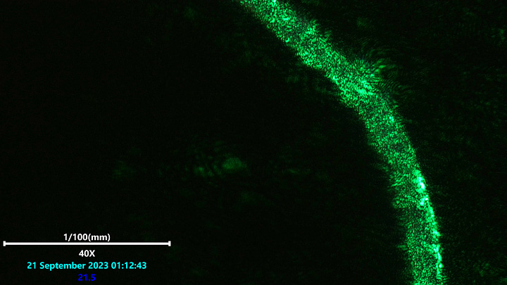 Laser scanning microscopy of polymer based fiber in blood showing the wavy pattern phenomena