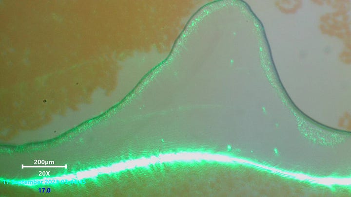 Laser scanning microscopy of gel like structures in blood. No noticeable activity after viewing these areas using a 532nm laser source for some time. These structures will usually expand and shrink on their own. A mata-material like wavy appearance can be seen aggrigated at the edges of the membrane.