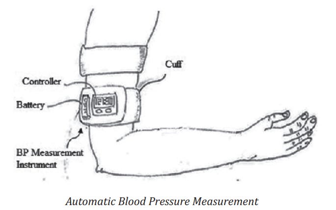 A Standalone, Portable Apparatus for Automatically Measuring Blood Pressure with Remote Monitoring