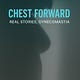 Chest Forward: Real Stories. Gynecomastia.