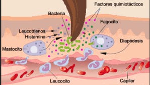 Herida en fase inflamatoria