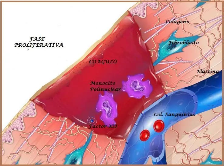 Tejido granulado en fase proliferativa