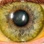 A Jaundiced Eye