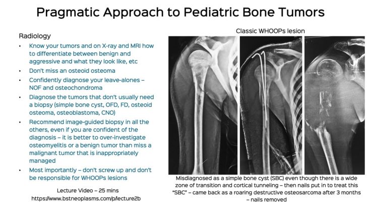 Lecture 2B: Pragmatic Approach to Pediatric Bone Tumors