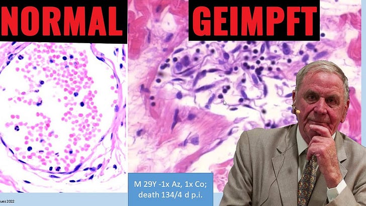21.5. - 20.6.23 Update: Corona, Impfung, alternative Behandlungen alles implodiert und damit die Welle der vielfältigen Abwehrreaktionen - Der Verantwortung will sich naturgemäß keiner stellen