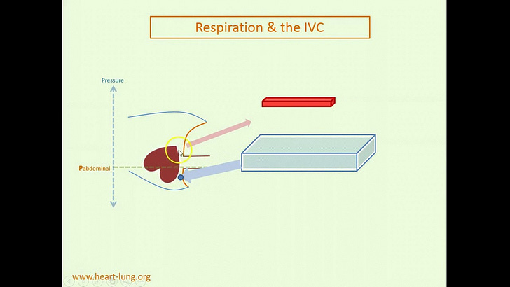 ICU Physiology in 1000 Words: IVC Collapse, Revisited – Part 1