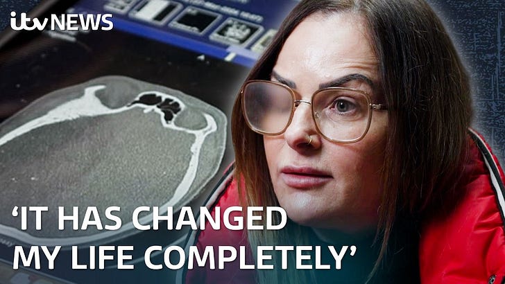 'I'll never look the same': The women with brain tumours after ...