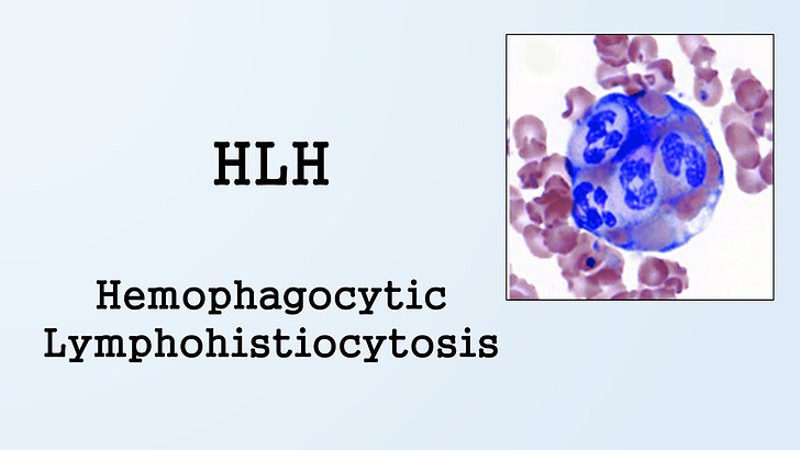 Secondary Hemophagocytic Lymphohistiocytosis (HLH) is descriptive of COVID and shot symptoms